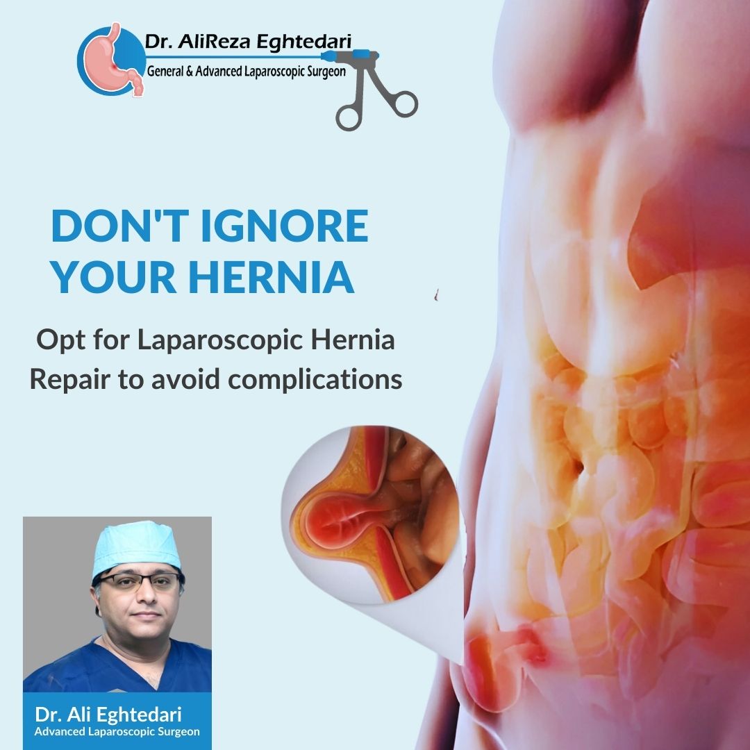 Hernia Surgery in Dubai Understanding the Procedure and Recovery Process